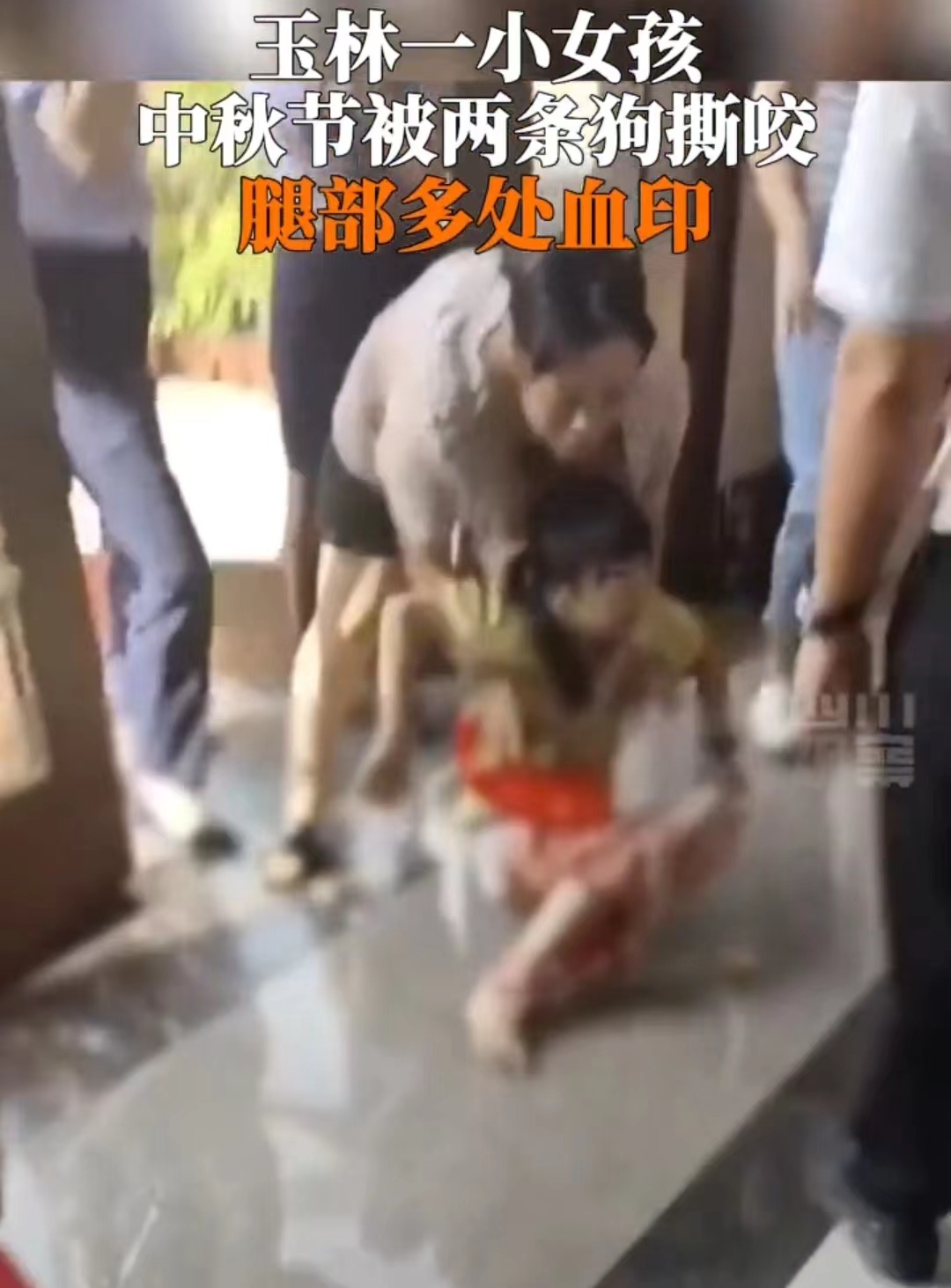 太震惊了 ！两只恶犬撕咬女孩……