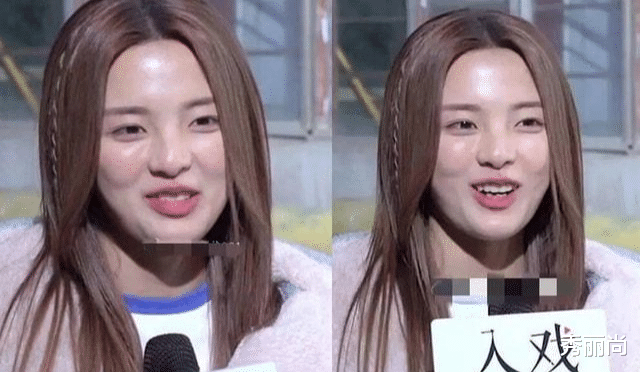 整容|“整容”不分年龄大小，这几位已经靠“玻尿酸续命”了