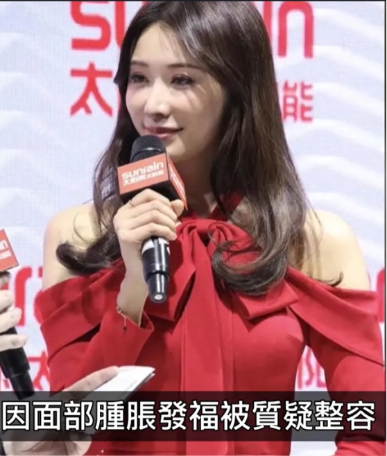 林志玲|林志玲被日本老公家暴？知情人曝其假体被打出，回台湾紧急修复