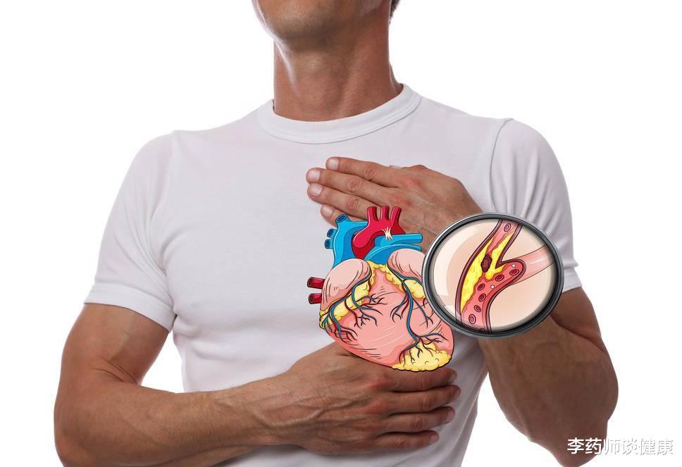 心血管疾病|阿司匹林和他汀，4个常见用药错误，一个也别犯