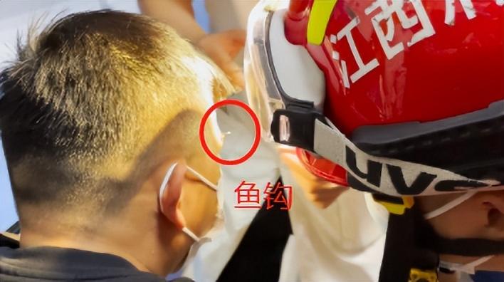 医生|看着都疼！男子夜钓鱼钩扎进前额……