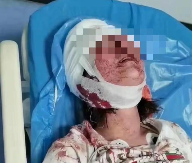 |陈继志哥哥发视频道歉,愿用100万求原谅,求和解!态度诚恳