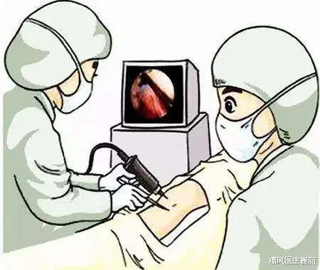 痛风|去除痛风石就像“挤牙膏”一样简单