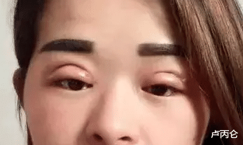 医生|为什么卢医生总说:别再修了,越修越假!