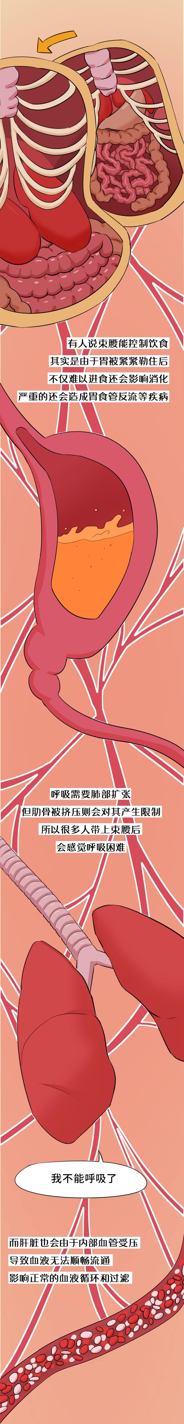 美容 “网红束腰带”，真能瘦身？（漫画）骗人的，莫让它“毁”了你！