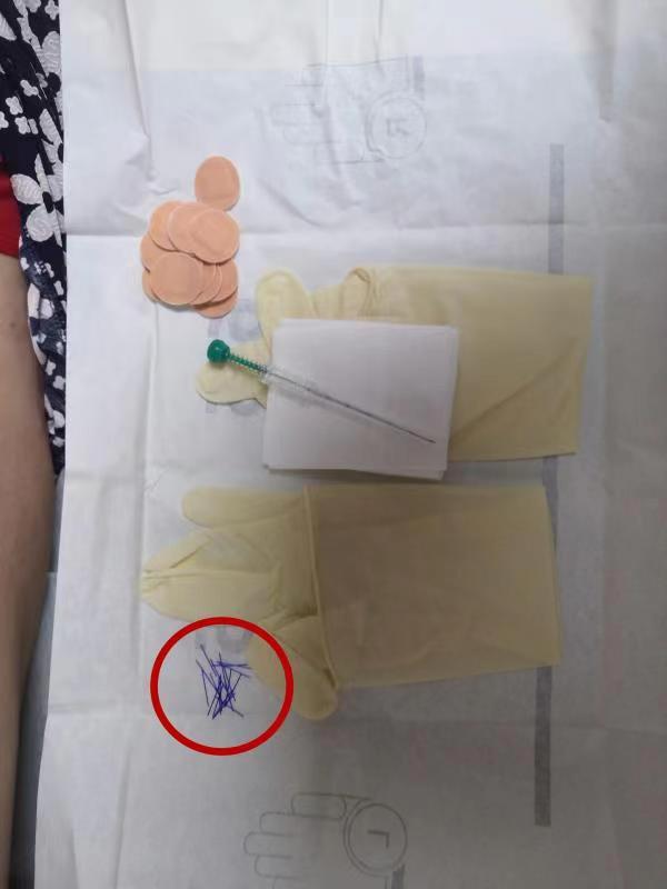 穴位|一根线埋进穴位 10天不停给患者做针灸市肺科医院把这个“针线活”创新应用到肺康复