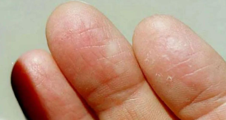 指纹的斗和簸箕,竟然藏着基因诅咒?中科院破解指纹基因奥秘