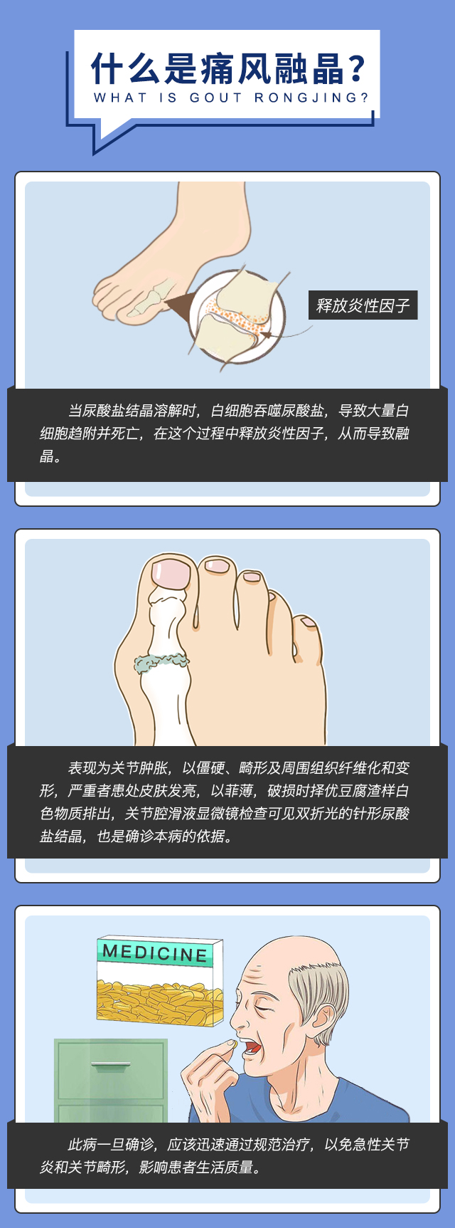 运动|鲁业东医生告诉你为什么痛风患者要融晶