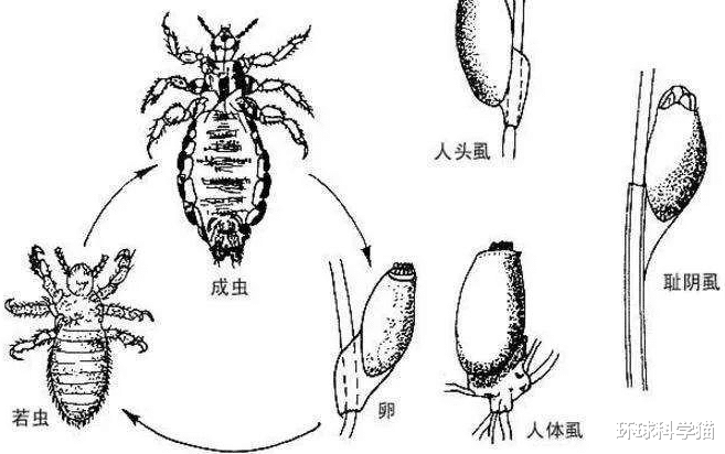 这是真的！与人类共存，活上千万年了，为何虱子现今很难见到了？