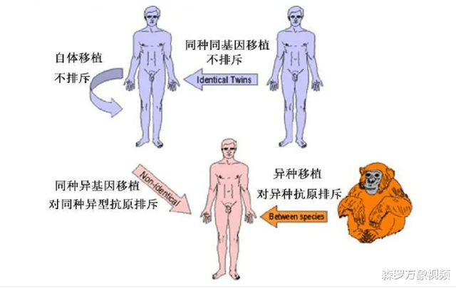 38年前,黑猩猩的心脏被医生移植给一名小女孩,最终怎样了?