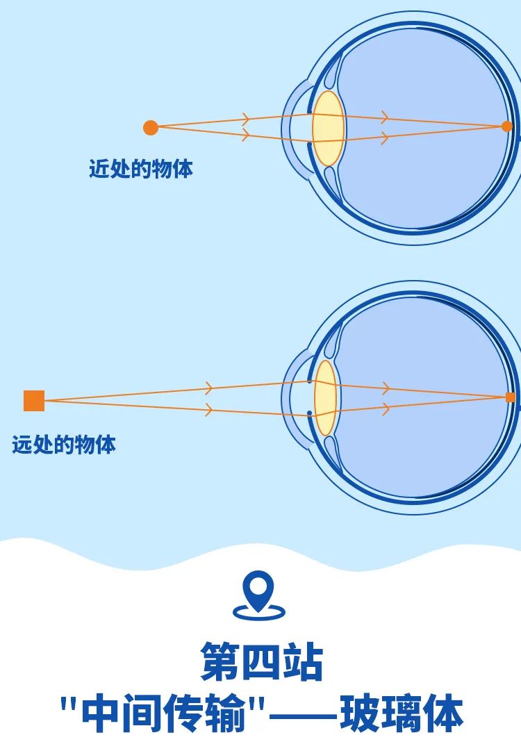 近视|你知道眼睛是如何工作的吗?