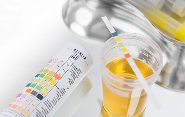 对乙酰氨基酚|肾病医生:肾衰不会突然出现,是尿蛋白“骗了”你