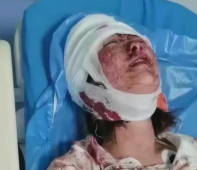 揪住“唐山被打女孩职业”不放,是明目张胆地替施暴者推卸罪责