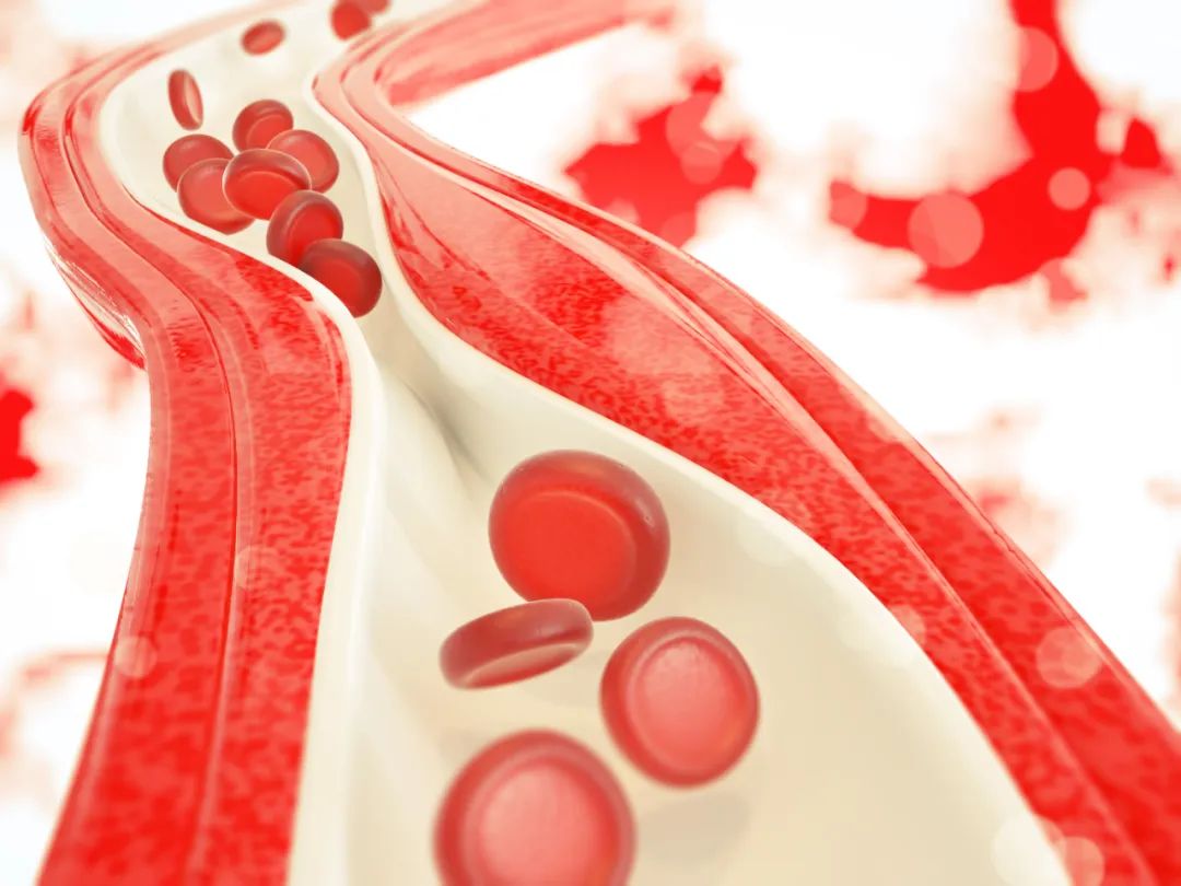 脂肪酸|动脉硬化是“男人最坏的敌人”!牢记5步养护法,疏通血管少堵塞