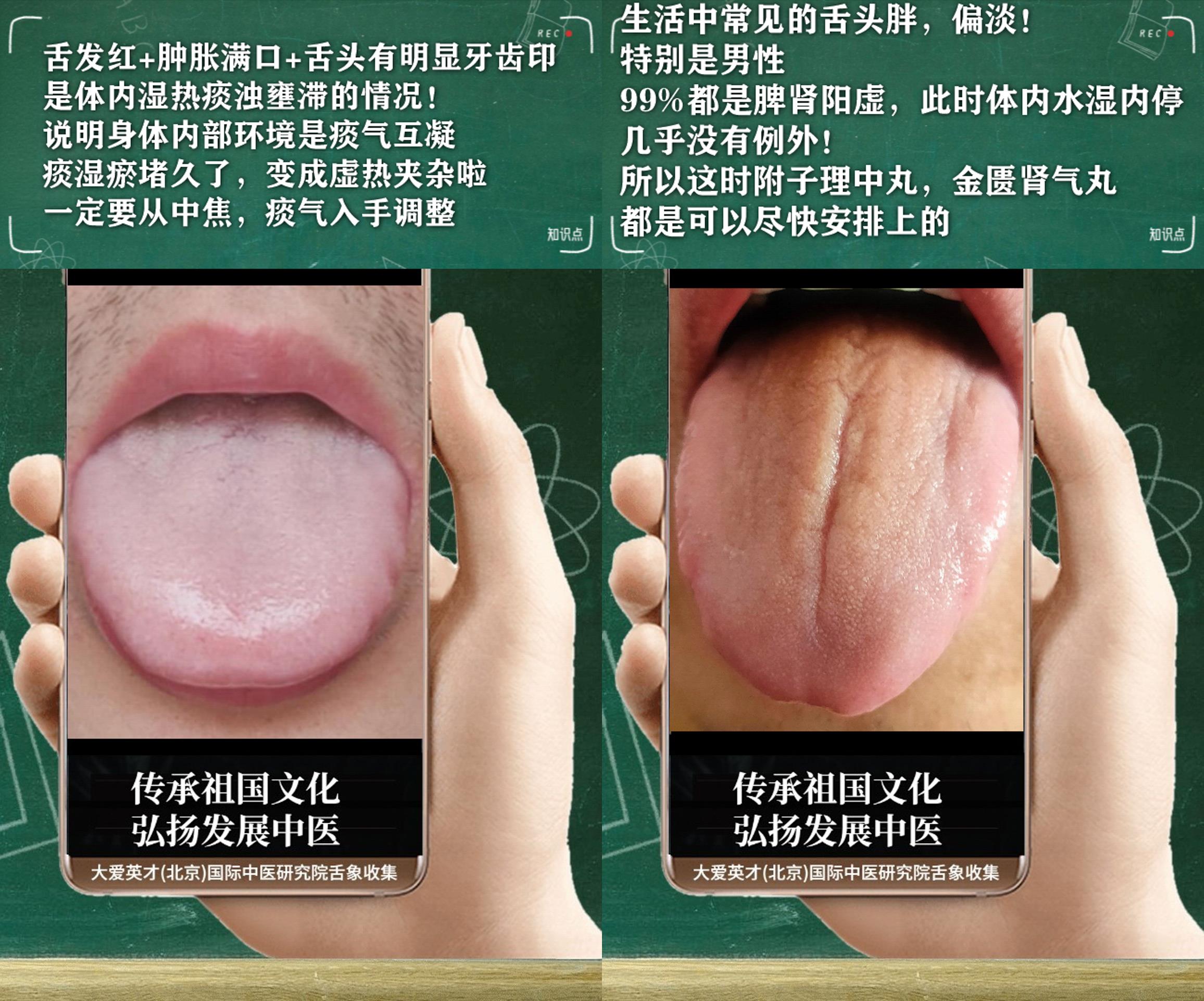 衰老|中医解剖:容易悲伤多虑,湿重痰多,反复胃胀,纳呆