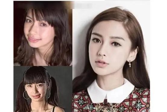 整容|娱乐圈整得最成功的三位女星，第一个靠整容出圈，她则全身都动过