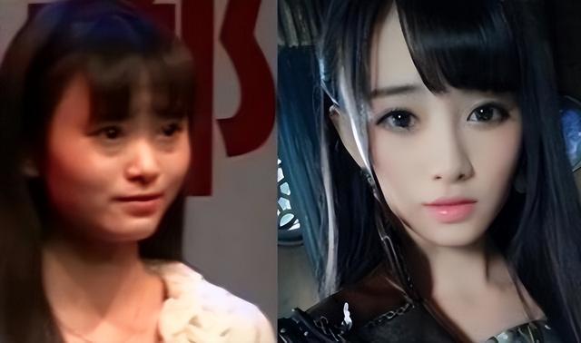 整容|鞠婧祎被质疑整容过度，犹如换头，后遗症正在慢慢出现