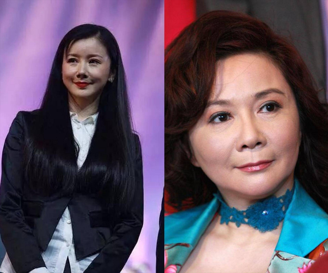 整容|长得“歪瓜裂枣”,整得“如花似玉”,这些女星都靠脸逆天改命