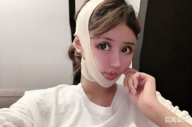 整容|15岁网红花400万整容，网友：和原生脸判若两人