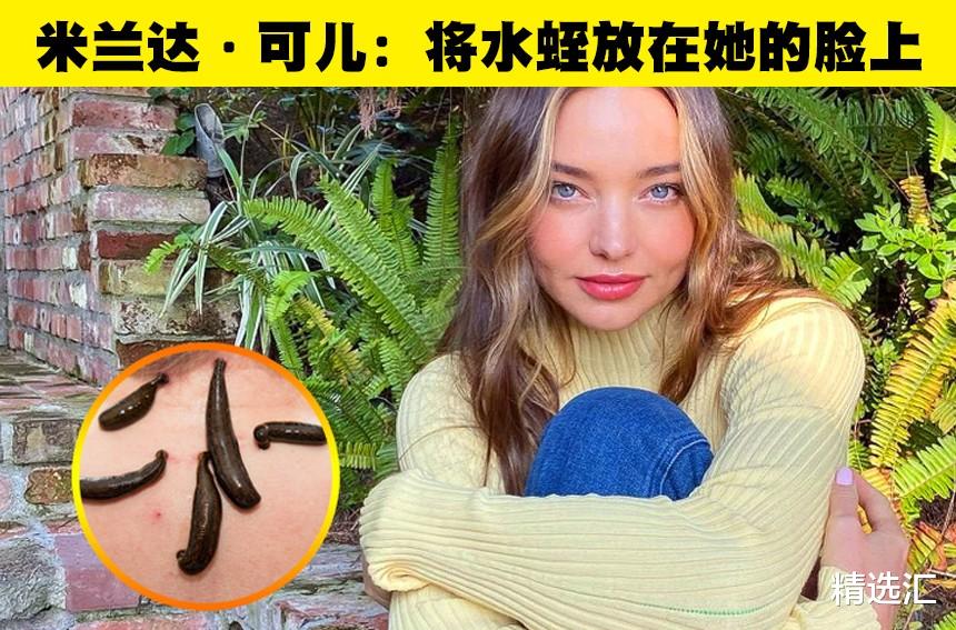 美容 将水蛭放在脸上?你不会想要尝试的8种名人喜欢的美容习惯