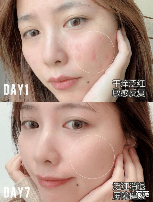 面膜 大牌护肤品被曝含致癌雌激素？网友：贫穷又一次救了我