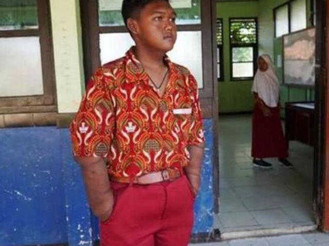 印度尼西亚 睡塌5张床,印尼400斤男孩立志要减肥,如今照片曝出,帅到认不出