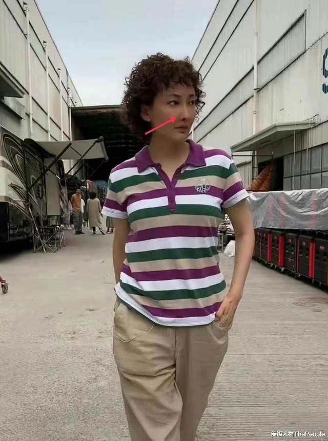 牛莉|喜剧女星也沉迷变脸!远看颜值逆天,实则鼻尖脸僵肿成发面馒头