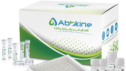 Abbkine EliKine人甲胎蛋白（AFP）ELISA定量试剂盒操作方法