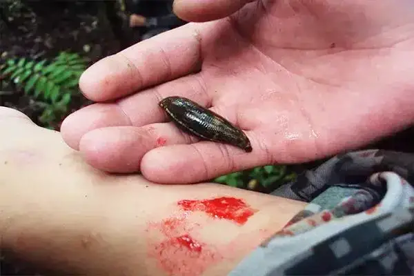 蚂蟥被鸡吞了会怎样?水蛭可以钻破鸡胃吗?吸附在人身上该怎么办