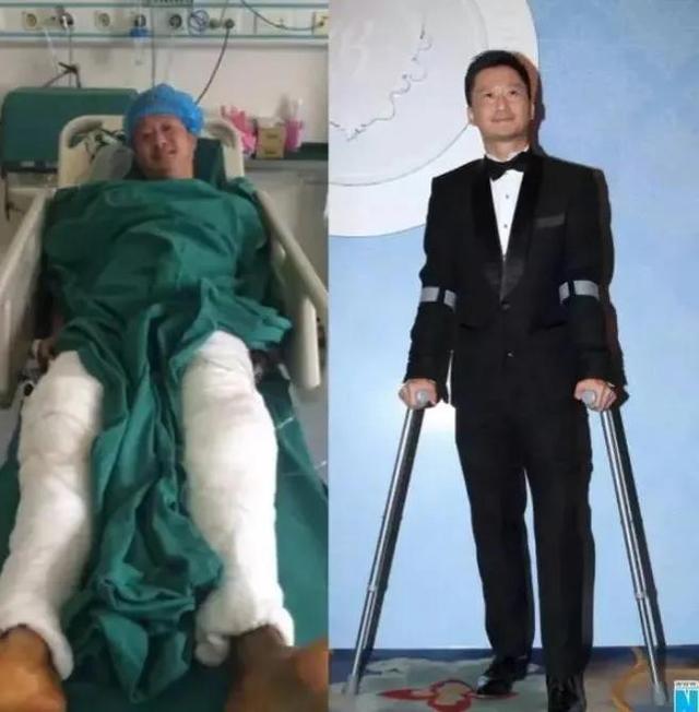 《战狼2》的时候,身体就有多处受伤,媒体更是曝光了吴京受伤住院的