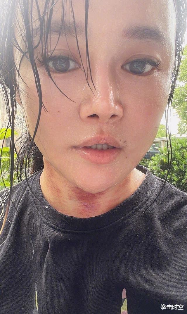 冉莹颖 痛心！冉莹颖为减肥身体出现变化，网友：姐姐你脖子上是怎么了