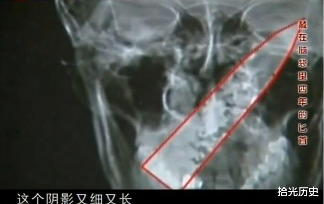 心脏|一男子小卖部生意差,原因竟是他口臭,而口臭的原因让人匪夷所思