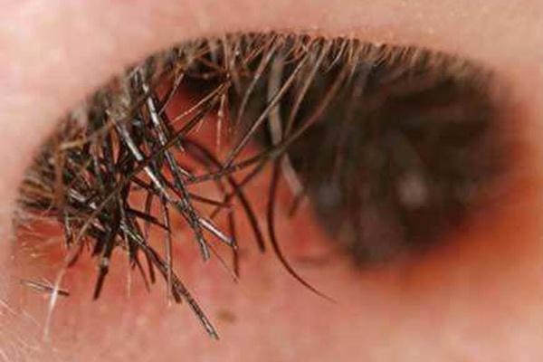 衰老|四十岁后,为何鼻毛变白了?可能和此事有关,无论男女或都逃不了