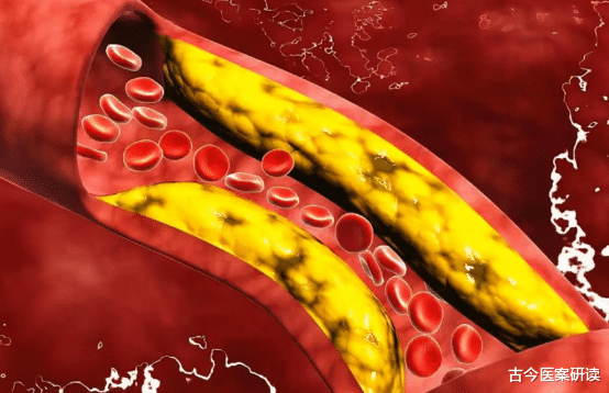 血糖|吃一口胜过6斤山楂,51岁大姐甘油三酯从8.6降至1.3,医生:值得学习