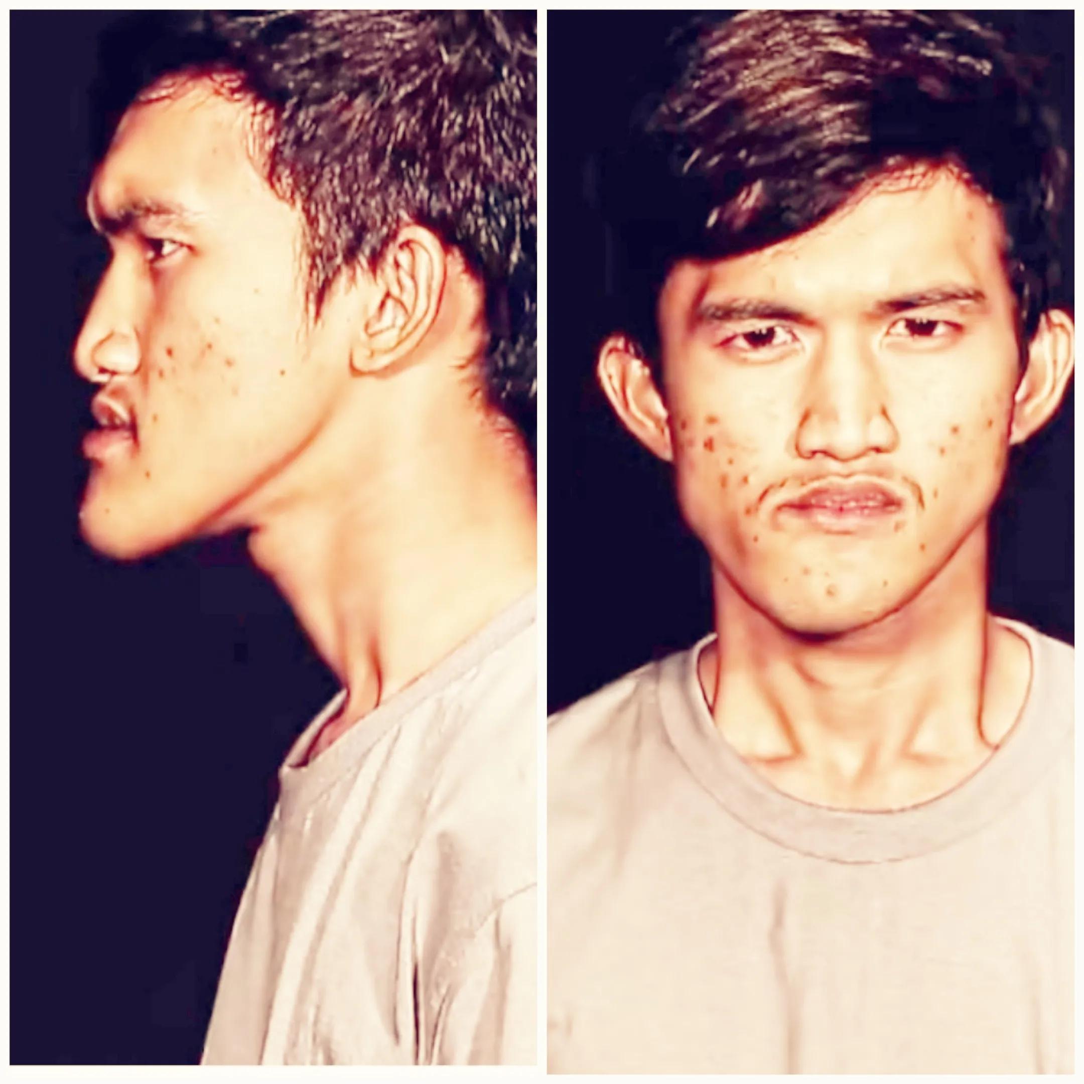 整容|韩国最强整容术:将一面貌丑陋变成帅气小鲜肉!