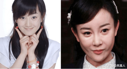 陈亚男|果然露馅了!凹陷、鼻梁中断,14位明星暴露动脸痕迹,看得心惊!