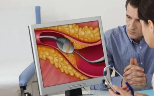 姐姐|血脂高，夏季不能吃“葡萄”吗？医生：降血脂，5种蔬菜或可常吃