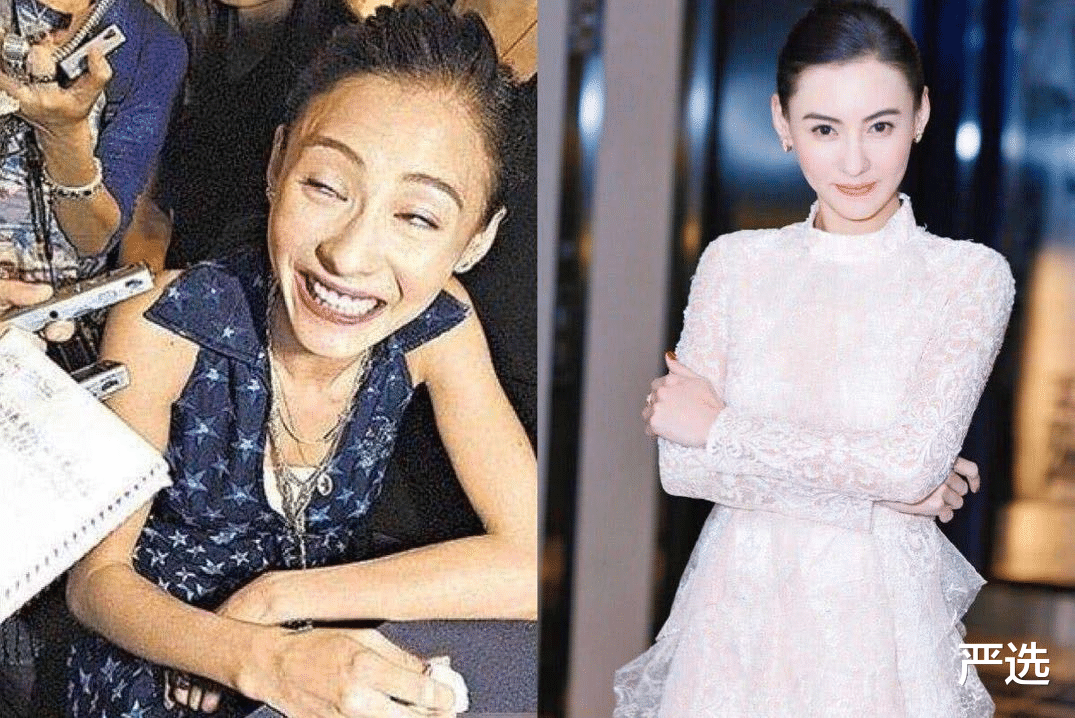美食 她才31岁脸就崩了?从来不承认整容,如今满脸硅胶感垮成“假人”