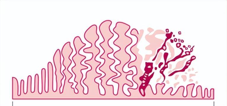 奥密克戎如何杀死你生殖细胞的?阳过以后,生殖细胞活动率仅剩2%