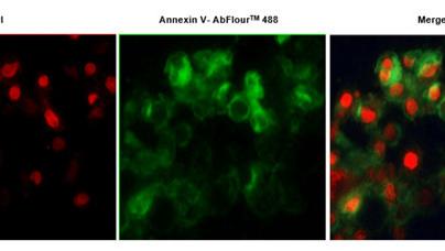 Abbkine AbFluor 488 细胞凋亡检测试剂盒特点及实验建议