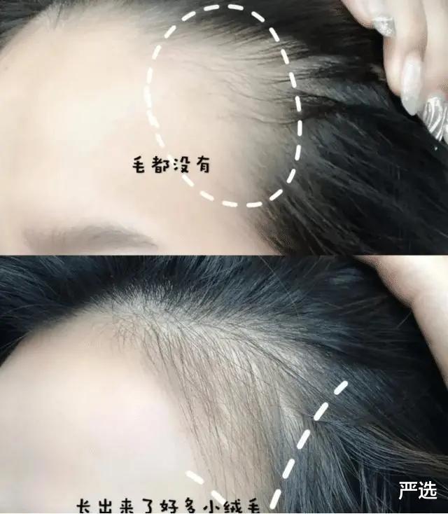 洗发水 曝光：这3种“洗发水”已经被列入黑名单，还有很多人在用，难怪会脱发