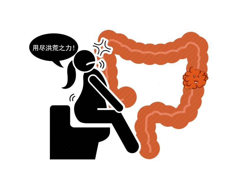 水果|清宿便、排肠毒给肠道洗个澡?提醒:你可能被忽悠了,别花冤枉钱