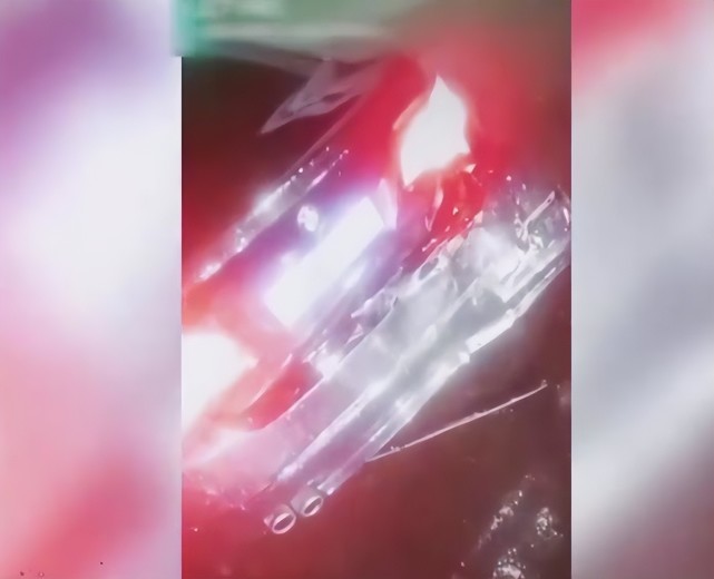 男子酒驾追尾宝马,为保工作跪求私了,第二天翻脸告其敲诈勒索