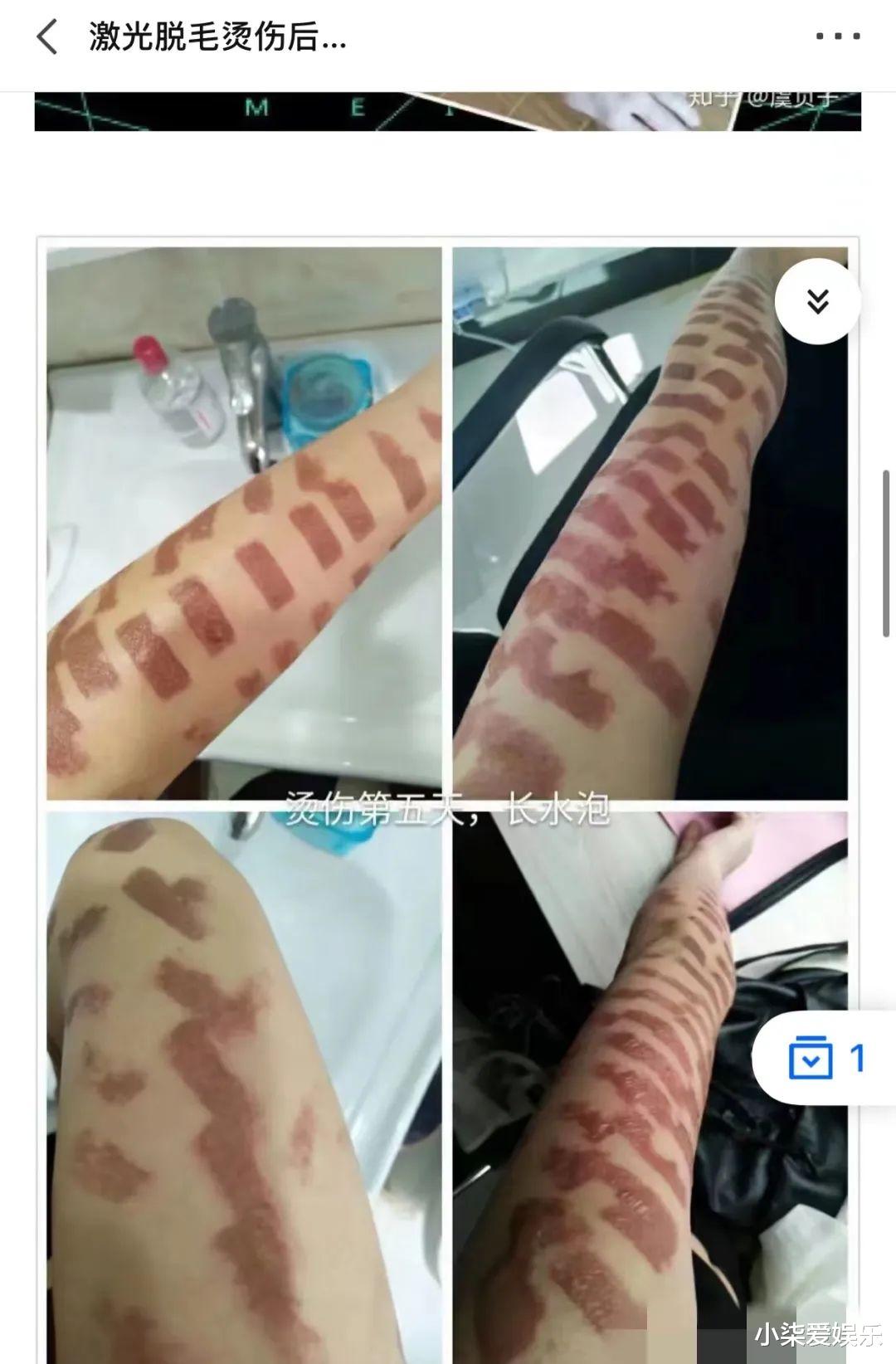 迪丽热巴|迪丽热巴“胸毛照”被骂上热搜,我看到了最恶心的一幕