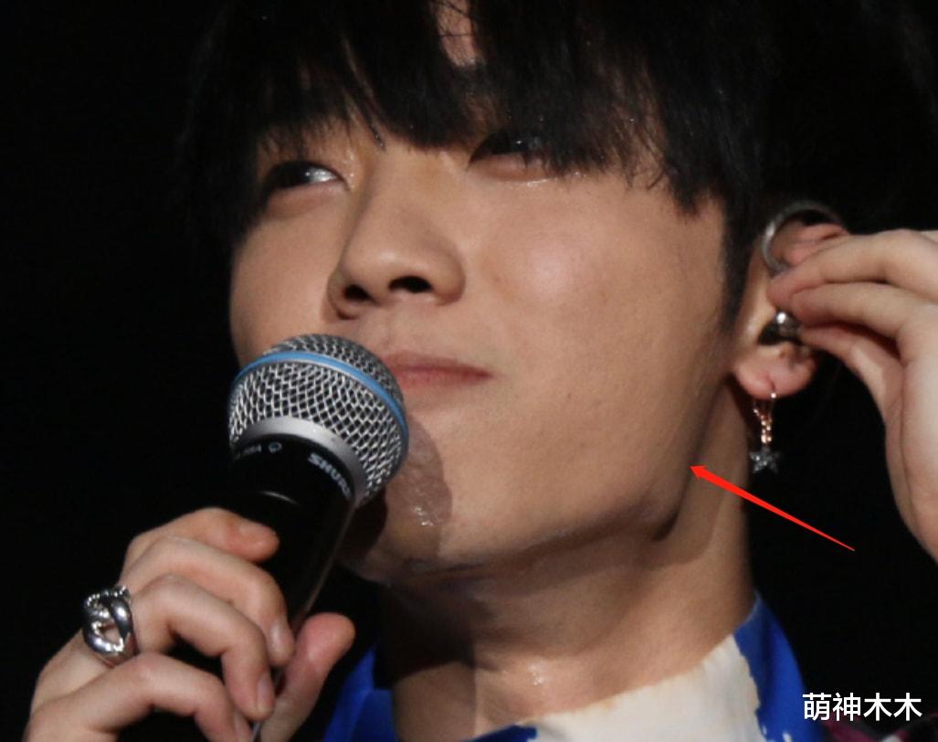 男星也有医美后遗症!华晨宇脸小挂不住肉,王一博法令纹越来越深