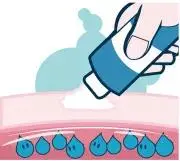 感冒|中医中药是如何治疗银屑病的?看完你就知道了