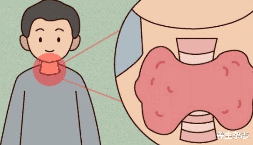 水果|多家医院联合声明:身体2处发痒,不是过敏,可能是甲状腺癌造访