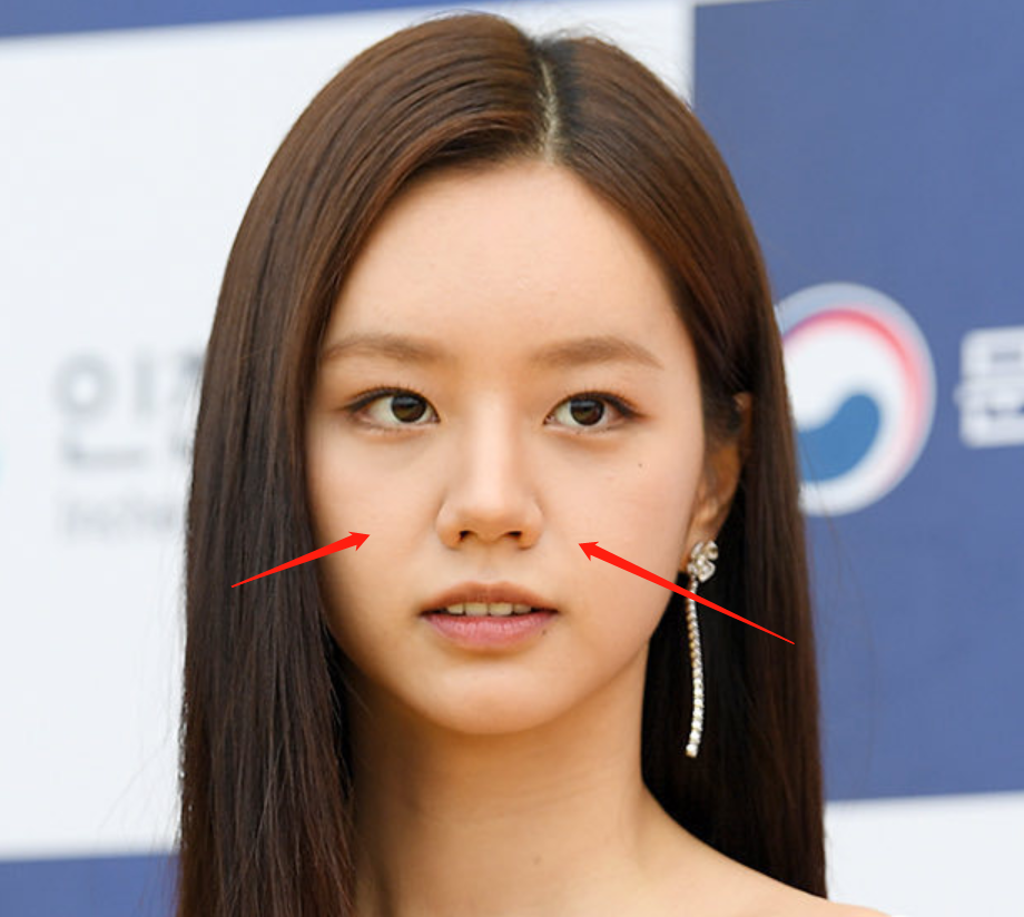 金高银|韩国青龙大赏明星生图！没了滤镜颜值集体掉线，金高银发际线堪忧