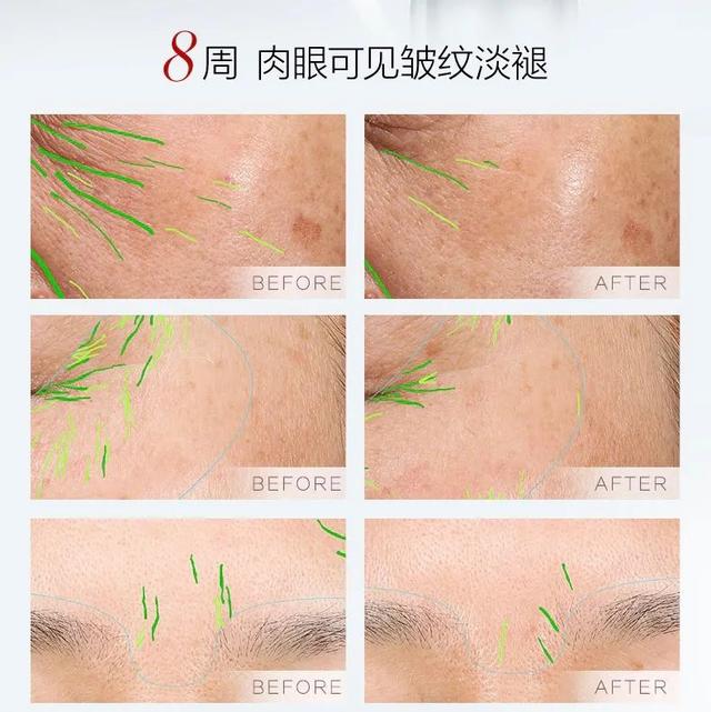 冰雪运动|更喜欢迪士尼公主们的后妈，是大势所趋嘛？