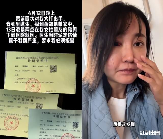 |徐大宝老公承认4次家暴!控诉女方婚内多次出轨,和导演关系暧昧